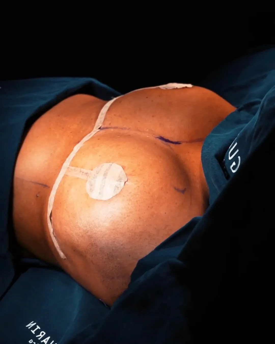 Before and after
