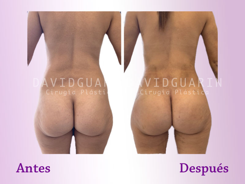 Before and after
