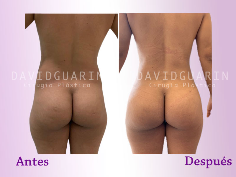 Before and after